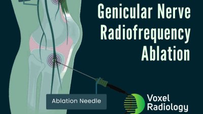 RFA availability in Bundaberg